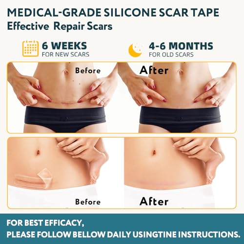 Save 38% on RWT Medical-Grade Silicone Scar Tape - Image 3