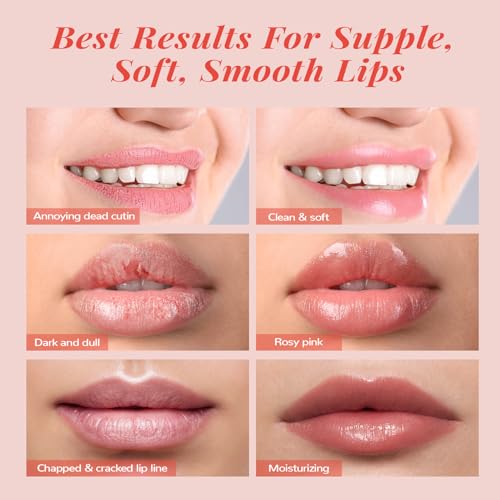 40% Off ANAI RUI Hydrating Lip Mask Set with Code DULOVG3X - Image 4