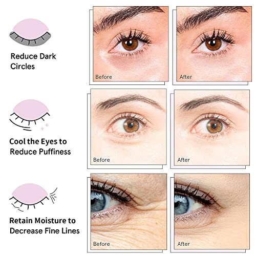 Save 30% on AVJONE 24K Gold Under Eye Patches (30 Pairs) - Image 2