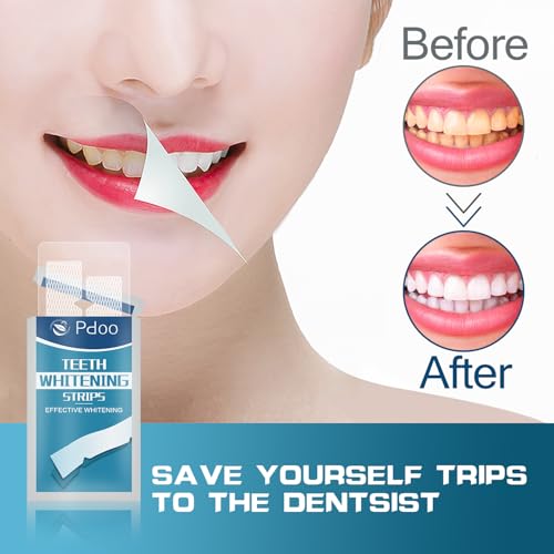 28% Off Pdoo Teeth Whitening Strips for Sensitive Teeth - Image 4