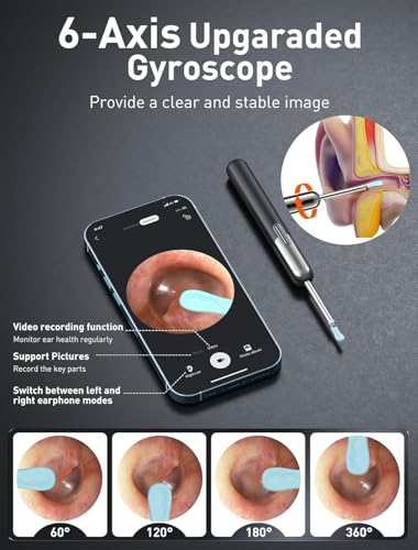 44% Off Ear Wax Removal Kit with 1080P Camera - Image 3