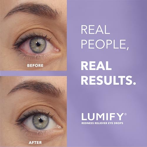 Save 8% on LUMIFY Eye Drops for Redness Relief - Image 2