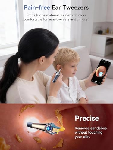 50% Off ZERONDER Ear Wax Removal Camera Otoscope - Image 4
