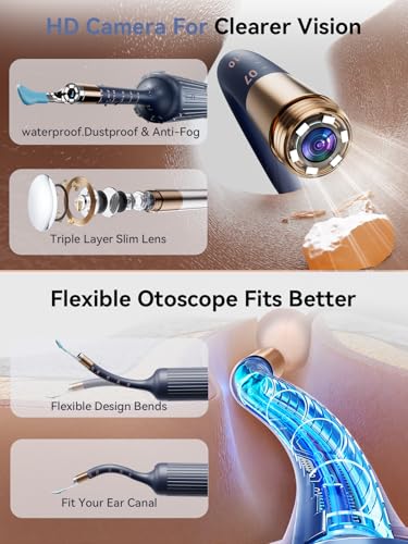50% Off ZERONDER Ear Wax Removal Camera Otoscope - Image 5