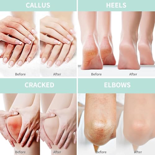 50% Urea Foot Cream with Coconut - Deep Moisturizing Deal - Image 4