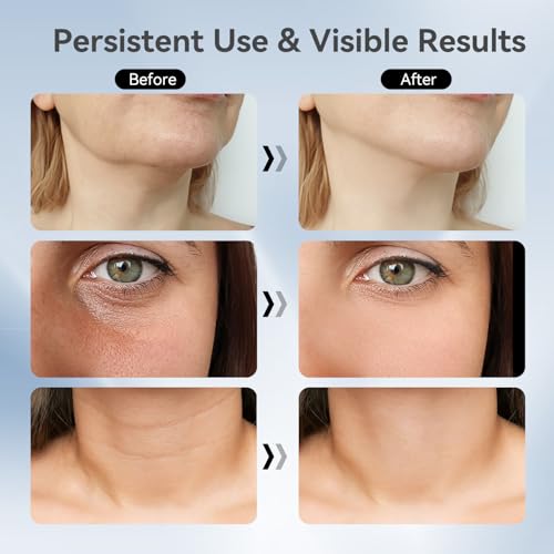 75% Off YUNRUO Neck Face Massager: Anti-Aging Deal - Image 4