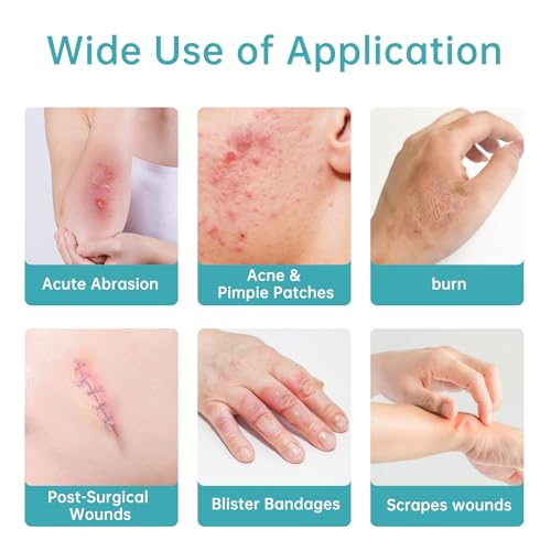 50% Off Medical Hydrocolloid Roll for Wound Care - Image 4