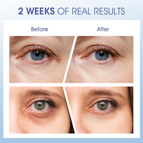 50% OFF Eye Cream Wrinkles Fine Lines with Code CP6VYJTG - Image 3