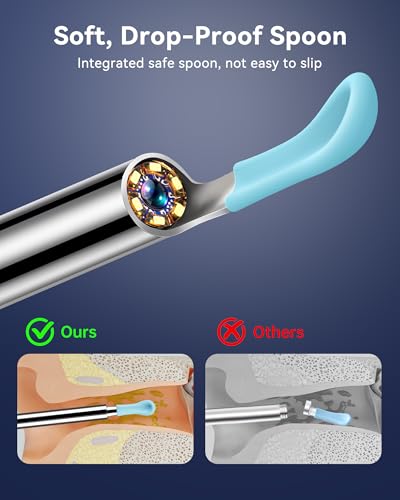 80% Off JEGOAT HD Ear Wax Removal Camera - Image 6