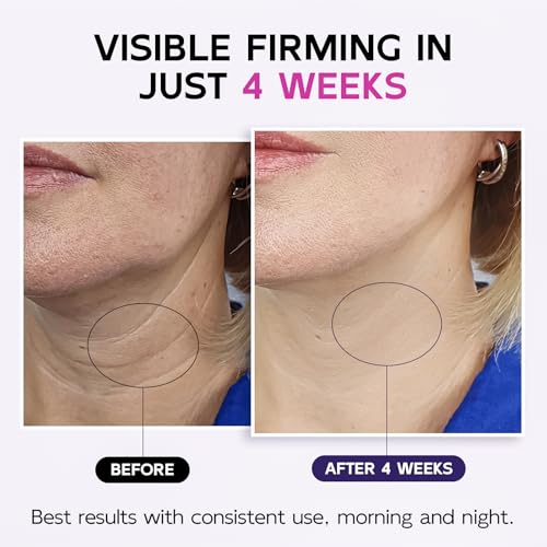 16% Off GOOSURE Neck Firming Cream w/ Roller & Code - Image 4