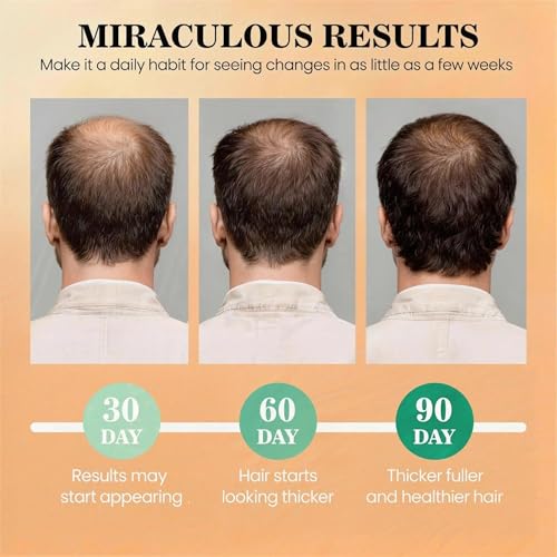 25% Off Batana Oil for Hair Growth – Use Code O7M6YGA9 - Image 5
