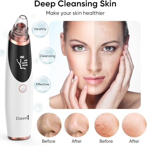 53% Off Daweir Blackhead Remover Pore Vacuum - Use Code 7D4NS5CV - Image 3