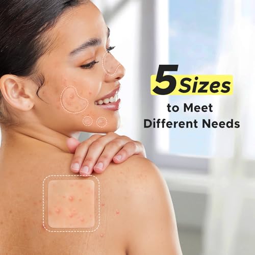50% Off LitBear Pimple Patches with Code D9LUYWB2 - Image 4