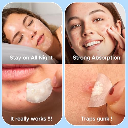 50% Off LitBear Pimple Patches with Code D9LUYWB2 - Image 5