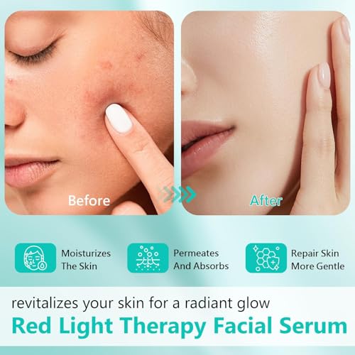 50% Off Ipsify Red Light Therapy Serum - Use Code IABK3W2W - Image 3